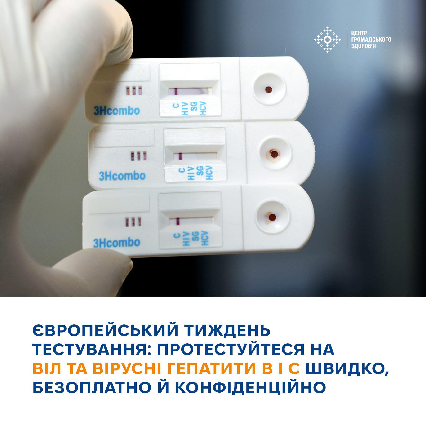 Європейський тиждень тестування